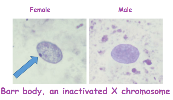 inactivated-X-chromosome